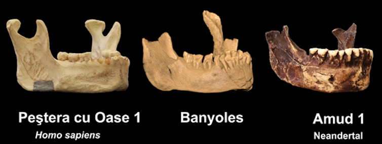 Three different lower jaw bones side by side
