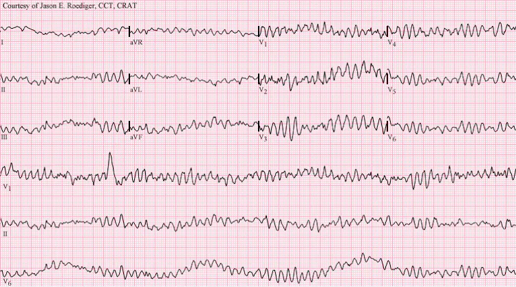 Six squiggly, erratic lines against a pink backdrop.