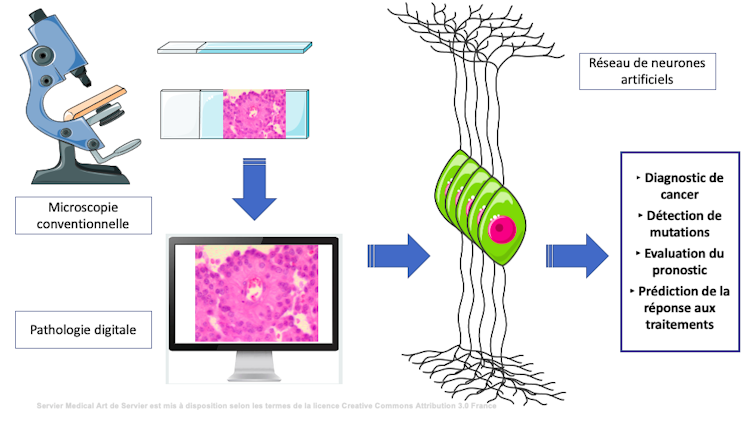 Infographie montrant le parcours des lames de microscopie, du microscope aux réseaux de neurones artificiels et algorithmes de traitement de l’information