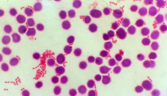 Micrographies de bactéries à Gram négatif et de cellules sanguines