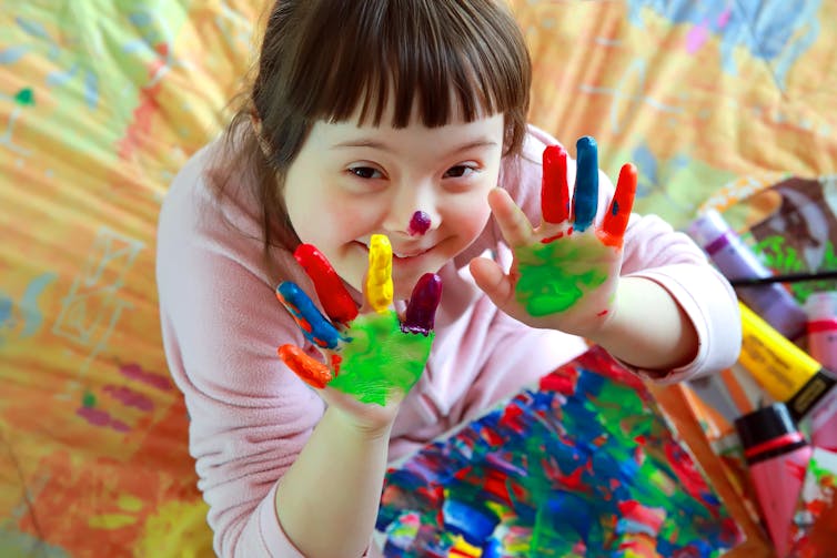 Girl with Down syndrome smiling with painted fingers