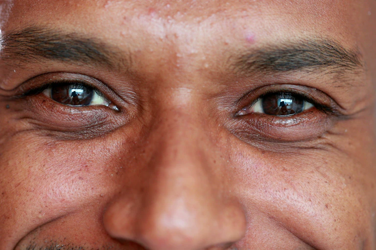 Close up of face focusing on brown eyes