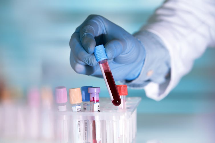 A lab worker wearing blue surgical gloves holds up a vial containing a blood sample.