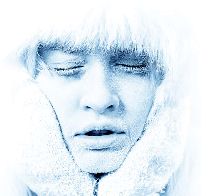 Visage blanc de gel d'une jeune femme