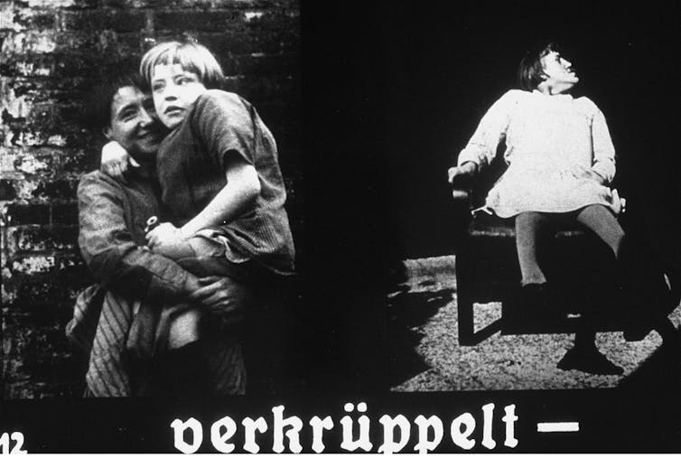 Images of physically disabled children, with a caption that reads 'deformed'.