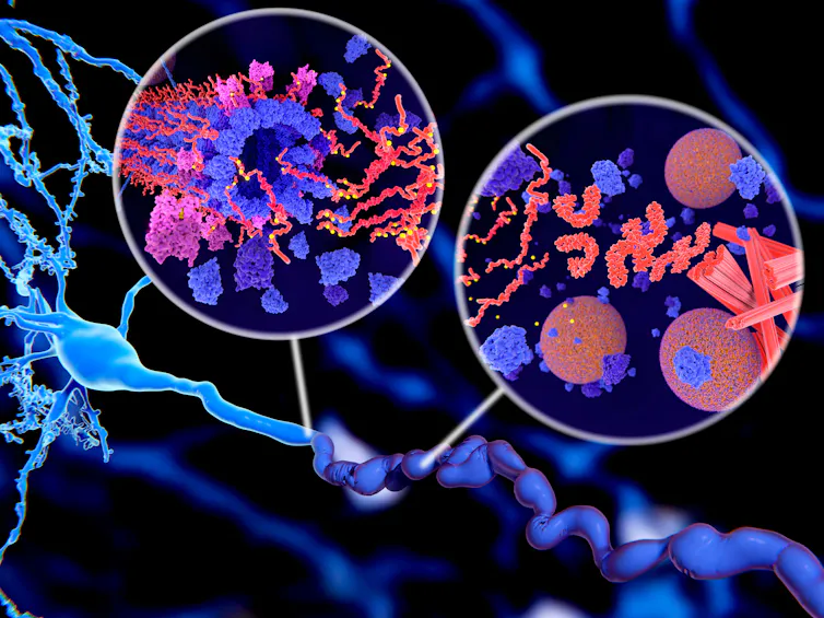 An artist's impression of a brain cell being destroyed by tau protein.