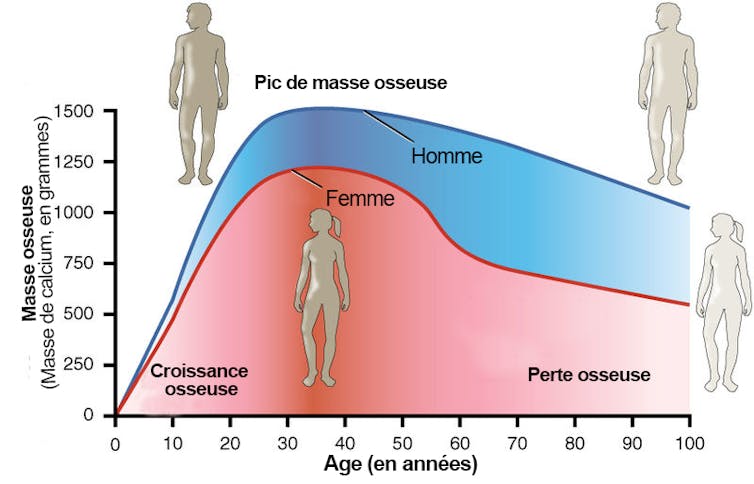 La densité osseuse est atteinte vers 30 ans puis diminue pour les deux sexes, quoique pas à la même vitesse