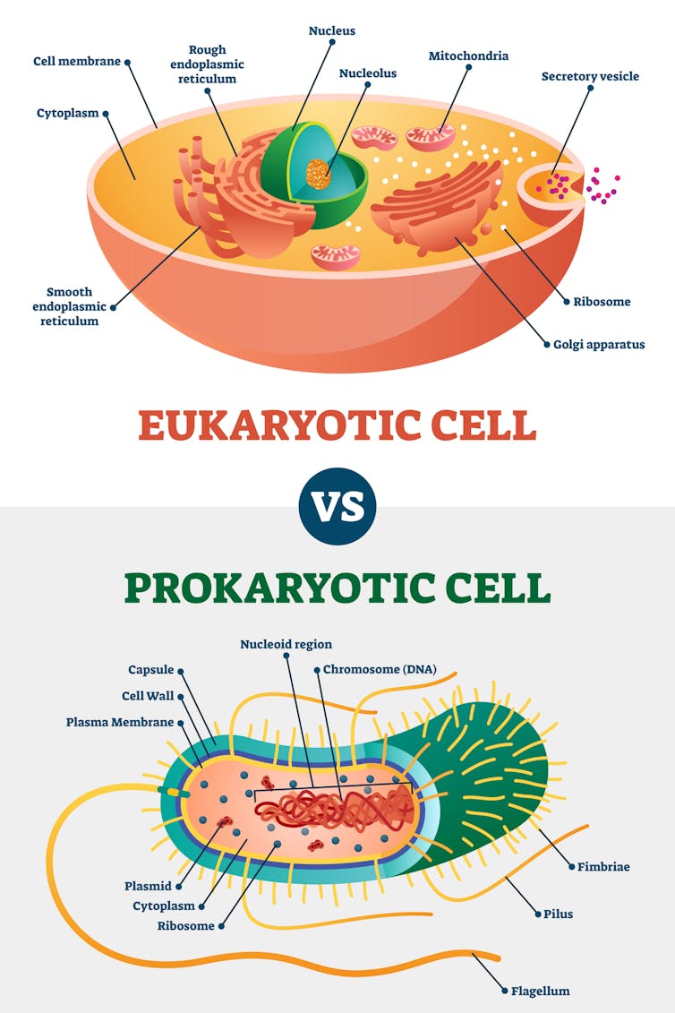 Diagram comparing a eukaryotic and prokaryotic cell