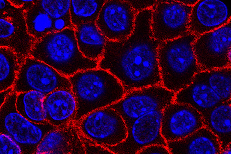 Image de microscopie montrant des cellules cancéreuses du pancréas (en bleu) en croissance (en rouge, les membranes).