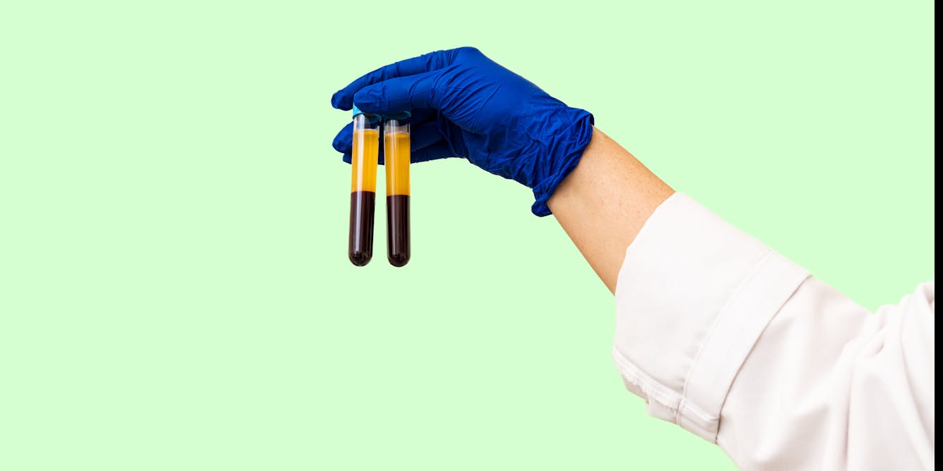 How Do Blood Tests Work? Medical Laboratory Scientists Explain the Pathway  From Blood Draw to Diagnosis and Treatment