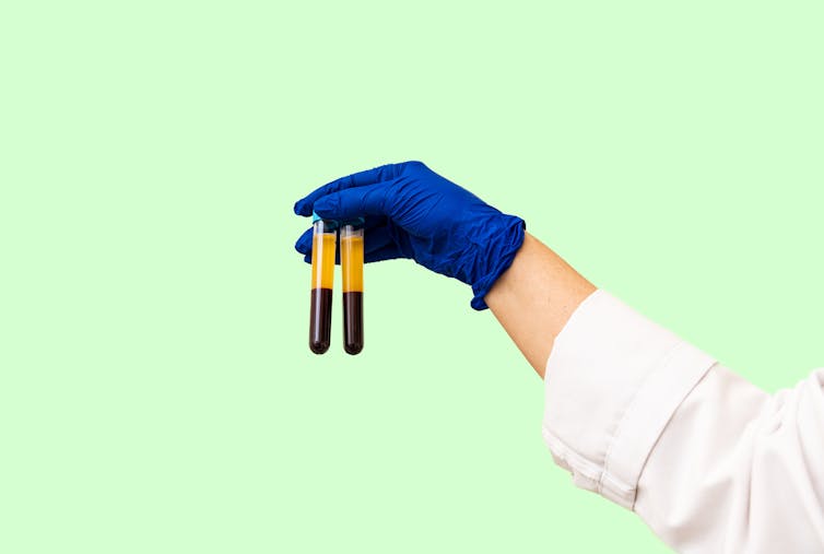 gloved hand holding two vials of blood samples on green background