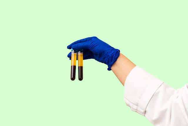 Arm of person wearing white lab coat and latex glove holding two blood tubes