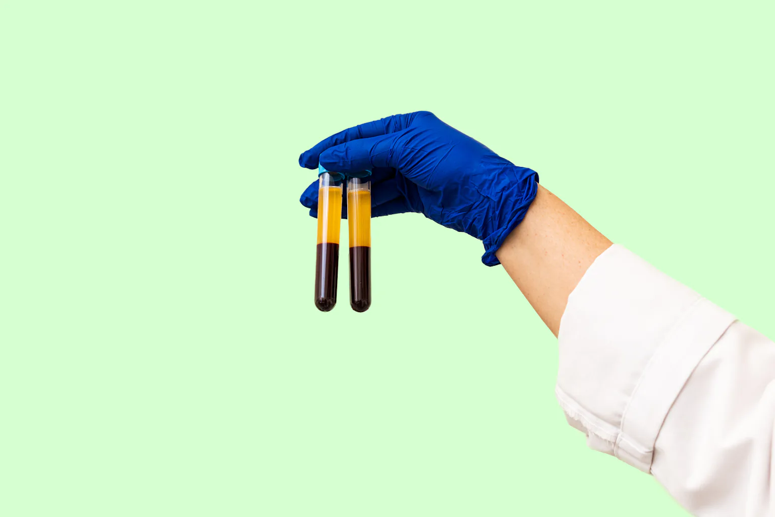 How do blood tests work? Medical laboratory scientists explain the ...