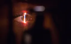 A closeup of an eye with a light shining on it.