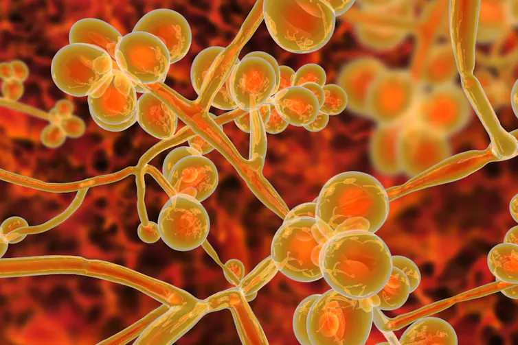 Candida auras