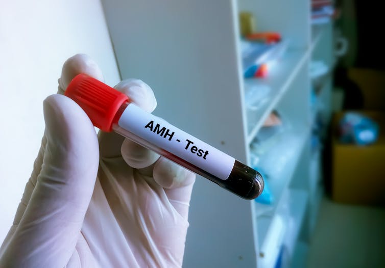 A lab worker wearing medical gloves holds a test tube of blood in their hand. The tube is labelled 'AMH test'.