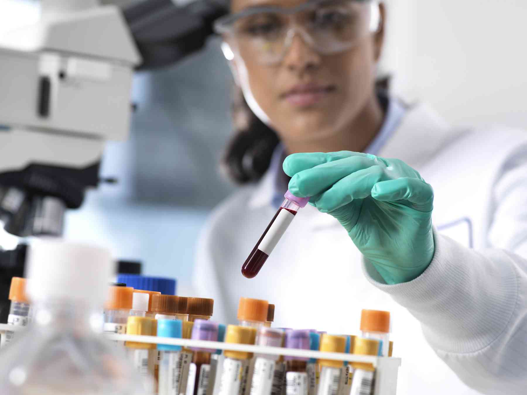 How do blood tests work? Medical laboratory scientists explain the