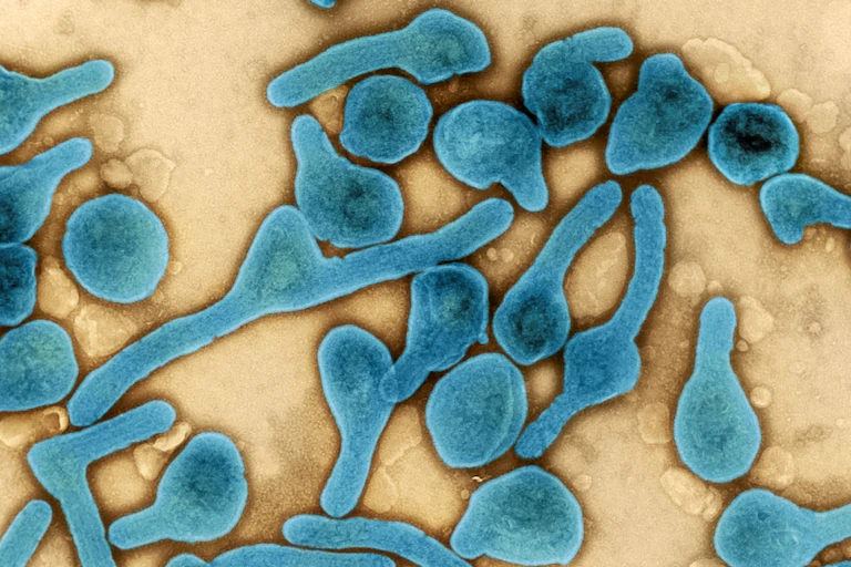 Micrographie électronique à transmission colorisée de particules du virus de Marburg (bleu, fausses couleurs) récoltées dans le surnageant de cellules VERO E6 infectées.