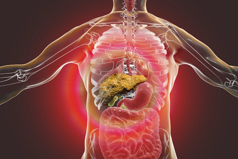 An illustration showing a transparent body with organs see-through and the liver shown scarred with cirrhosis.