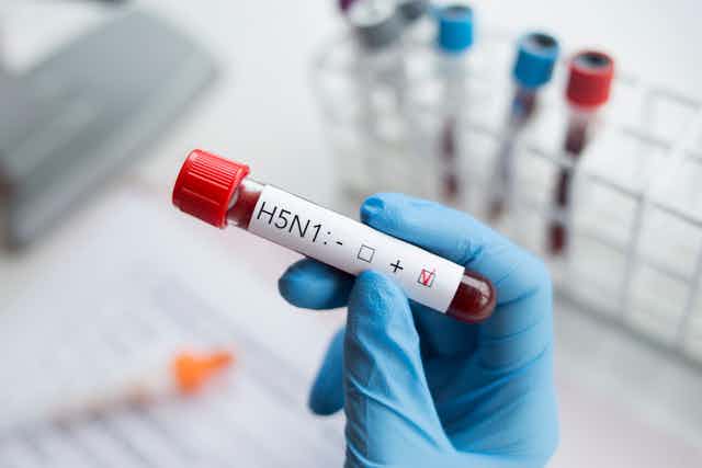 Muestra de sangre positiva con el virus de la gripe H5N1.