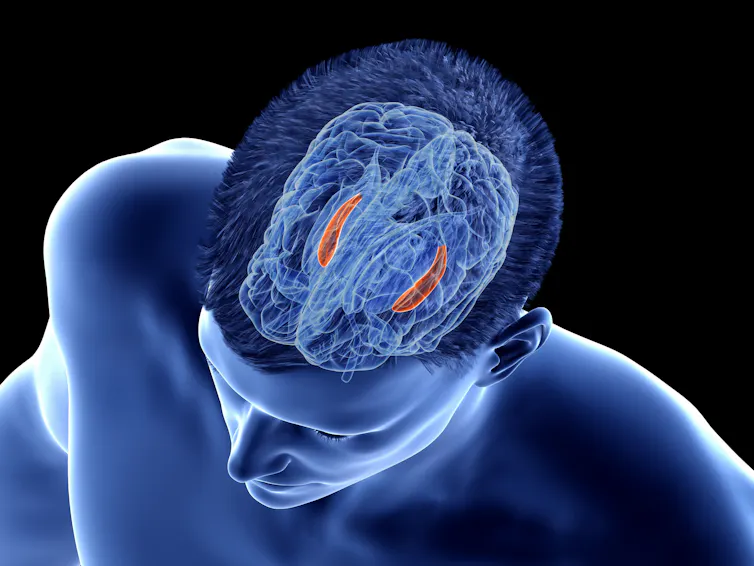 two bits of human brain are highlighted, one on each side