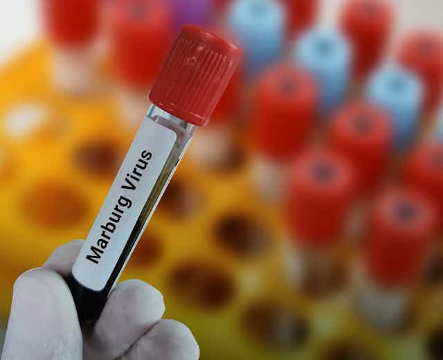 Vial of blood labelled with Marburg virus