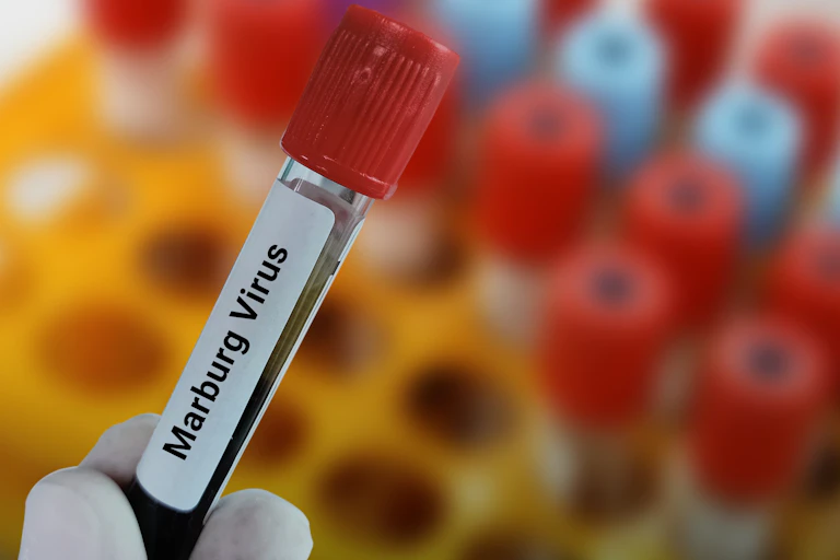 Vial of blood labelled with Marburg virus