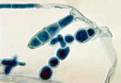 Blue organisms growing from translucent stalks