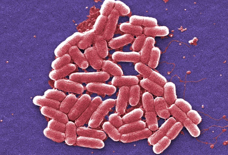 micrograph image of bacteria