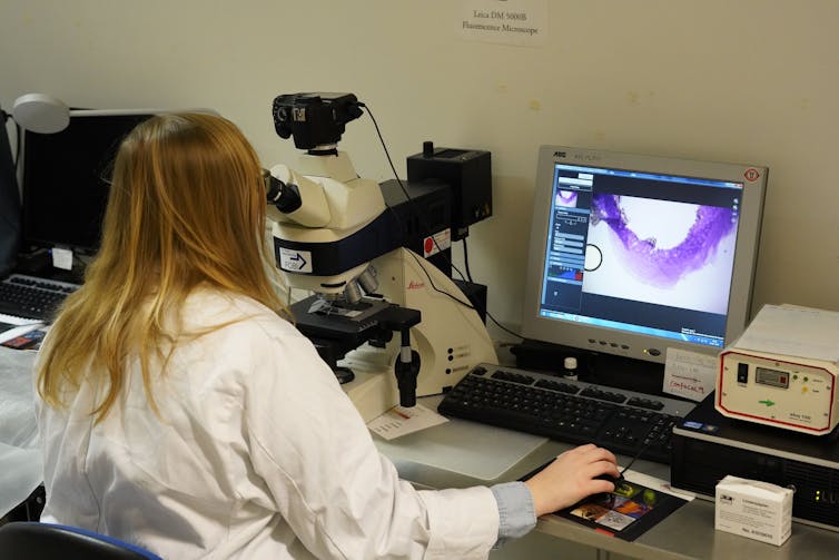 A woman looking into a microscope with a hedgehog jawbone printed on a computer screen in front of her.