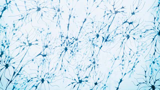 Microscopy image of neurons
