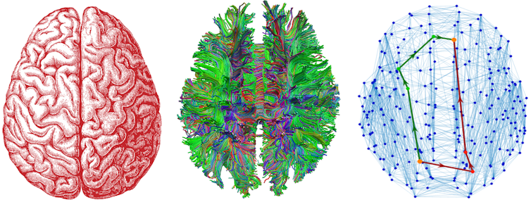 Three colourful images of the human brain in various stages of abstraction