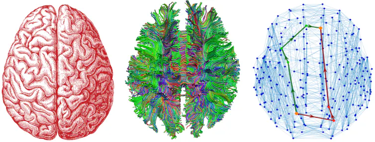 Three colourful images of the human brain in various stages of abstraction