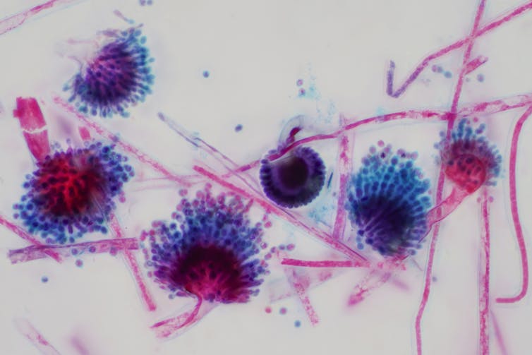 Microscopy image of _Aspergillus_