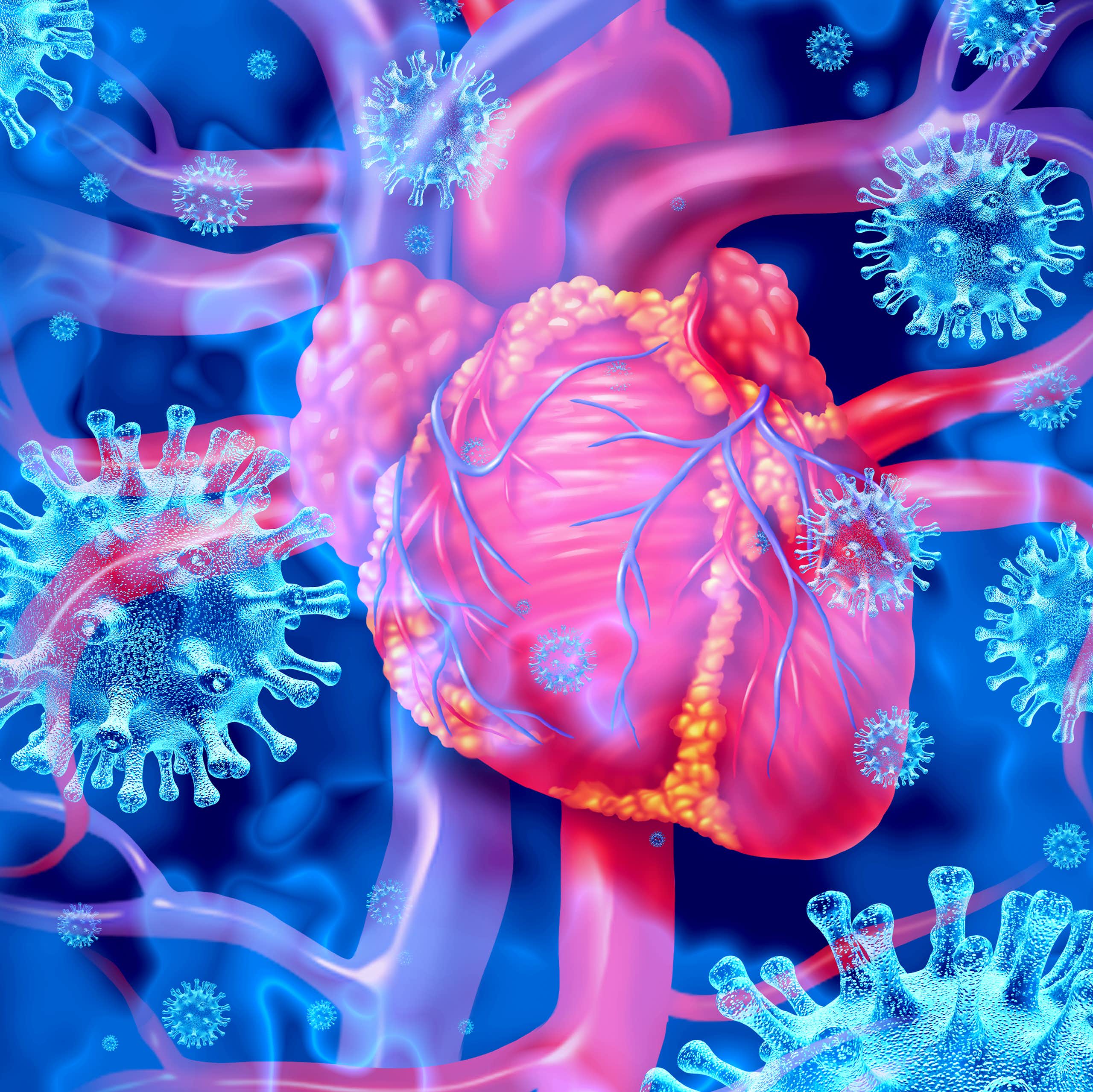 Three-dimensional rendering of a heart with inflammation from viral myocarditis, against a background of COVID-19 viral particles.