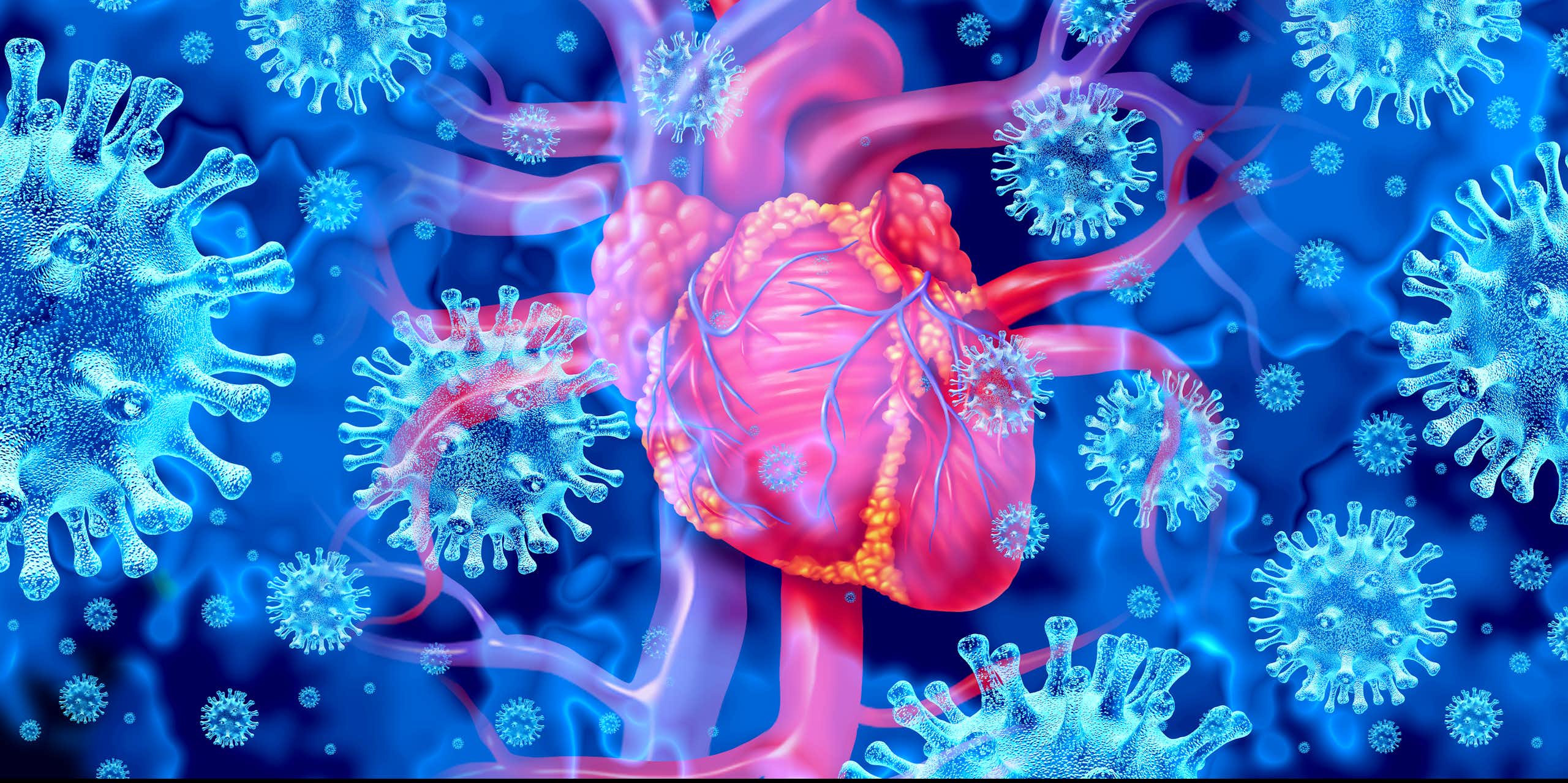 Three-dimensional rendering of a heart with inflammation from viral myocarditis, against a background of COVID-19 viral particles.