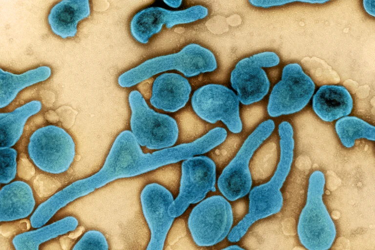 Microscopy image of Marburg virus particles
