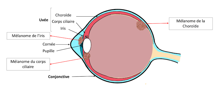 Vue en coupe de l’œil et localisation des trois tissus de l’uvée, au niveau de l’œil