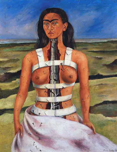Self-portrait of Frida Kahlo showing a Mexican woman in a body brace.
