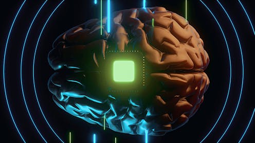 We've been connecting brains to computers longer than you’d expect. These 3 companies are leading the way