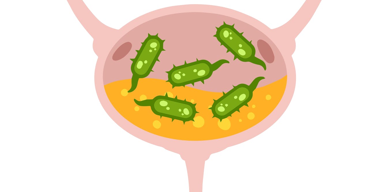 Urinary Microbiota What Are Its Many Impacts On Our Health Archyde urinary-microbiota-what-are-its-many-impacts-on-our-health-archyde