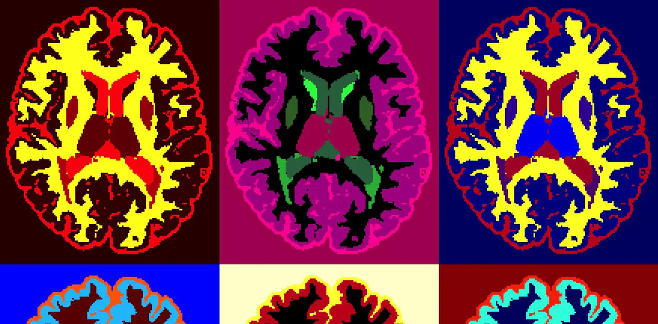 peut-on détecter le mensonge grâce à l’imagerie médicale ? peut-on détecter le mensonge grâce à l’imagerie médicale ?