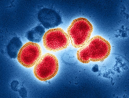 Klad virus flu burung di Kamboja begitu cepat terindetifikasi, kenapa bisa begitu?