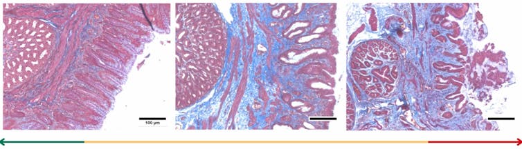 images of birds' stomach tissues, stained pink and blue.