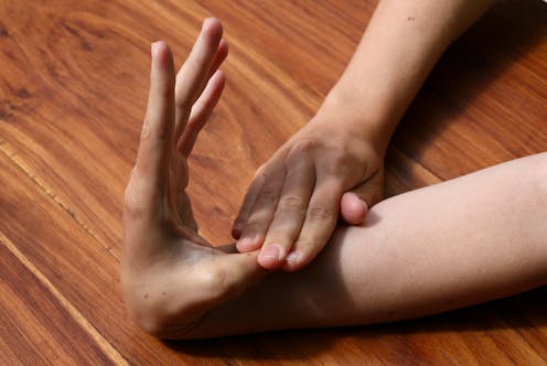 Bendy joints, stretchy skin, clumsiness. Why hypermobile Ehlers-Danlos Syndrome is often missed – and what it has to do with autism