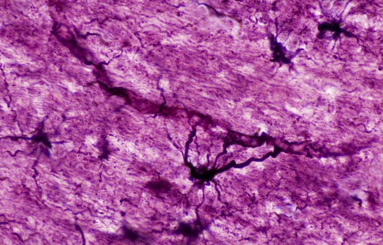 Microscopy image of astrocytes contacting a capillary