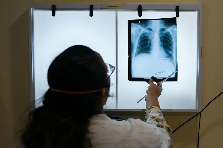 A woman in a white coat examining a chest x-ray on a lit-up screen