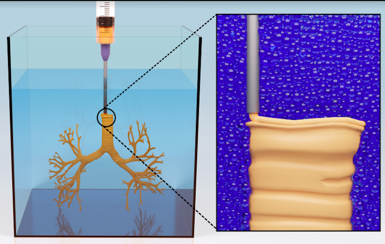 Diagram of AMULIT technique printing the bronchi of a lung model within a bath of supporting material, with a close-up of the needle depositing layers of silicone to make the tissue.