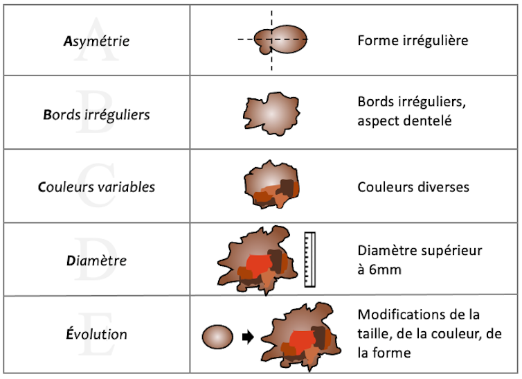 Changement dans la taille, la couleur, la forme… font partie des signes à surveiller