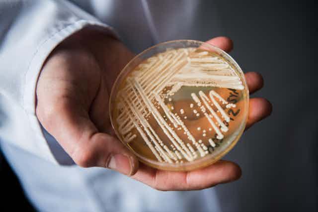 Person in a white coast holding a petri dish containing candida auris yeast